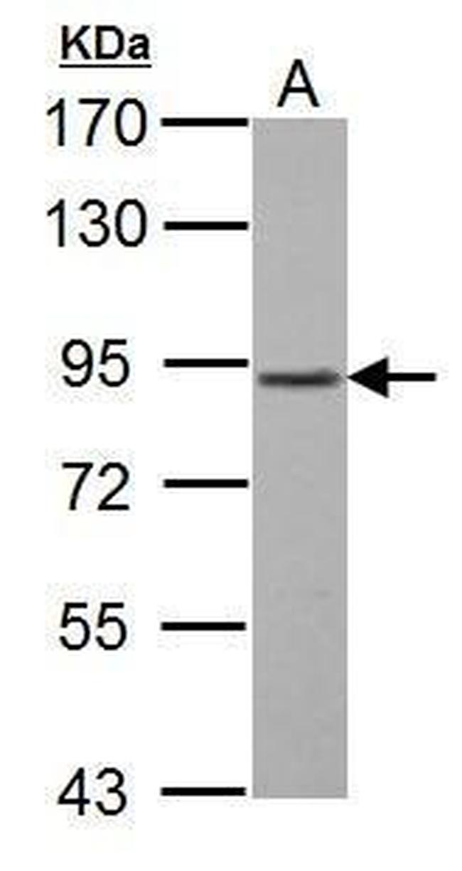 GABBR1 Antibody in Western Blot (WB)