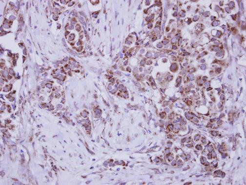 MUSK Antibody in Immunohistochemistry (Paraffin) (IHC (P))