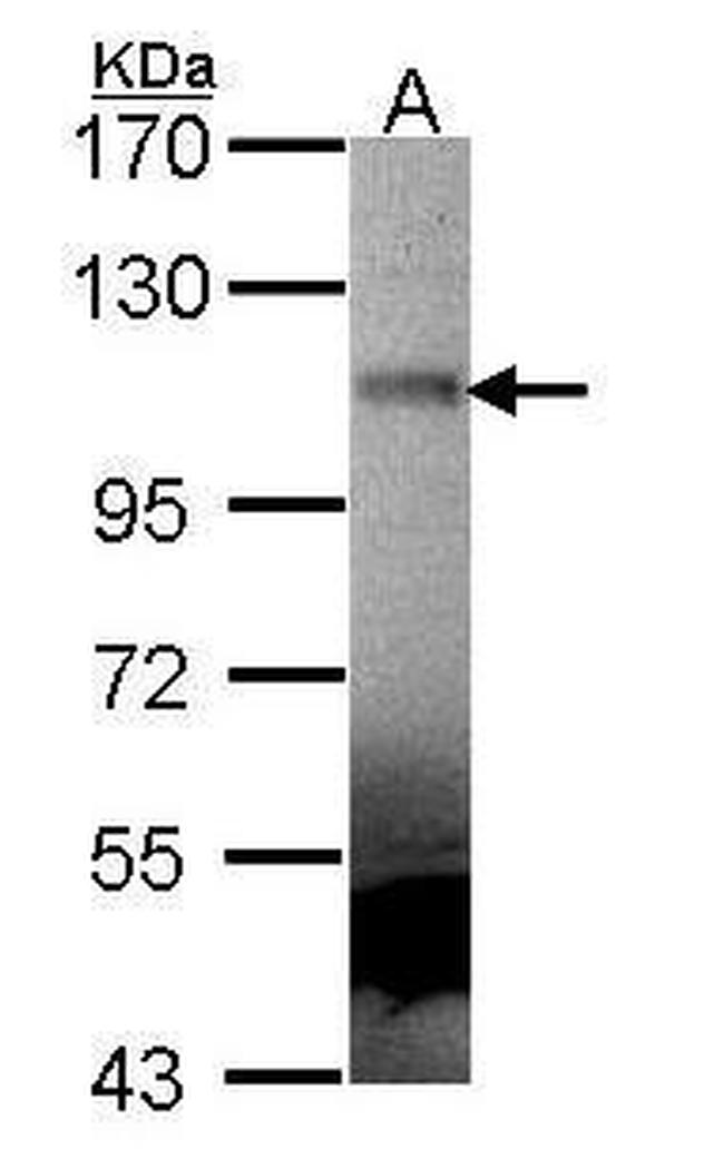 MUSK Antibody in Western Blot (WB)