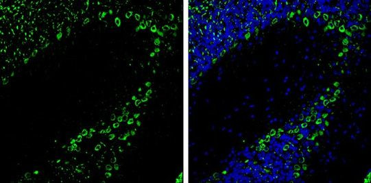 PKC gamma Antibody in Immunohistochemistry (Frozen) (IHC (F))