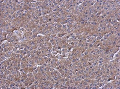 PTPN12 Antibody in Immunohistochemistry (Paraffin) (IHC (P))