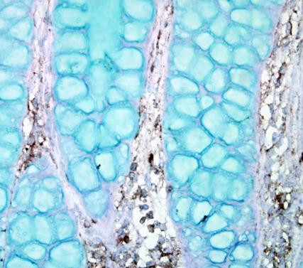 PTPN12 Antibody in Immunohistochemistry (Paraffin) (IHC (P))