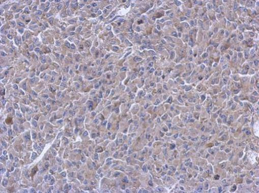 PTPN12 Antibody in Immunohistochemistry (Paraffin) (IHC (P))