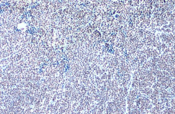 GABPA Antibody in Immunohistochemistry (Paraffin) (IHC (P))