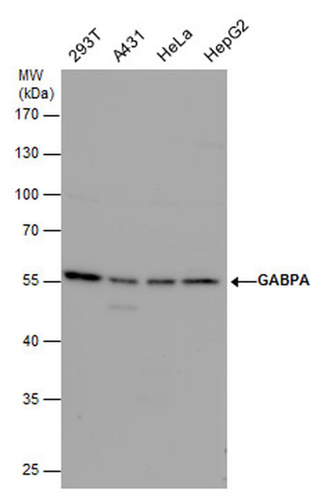 GABPA Antibody in Western Blot (WB)