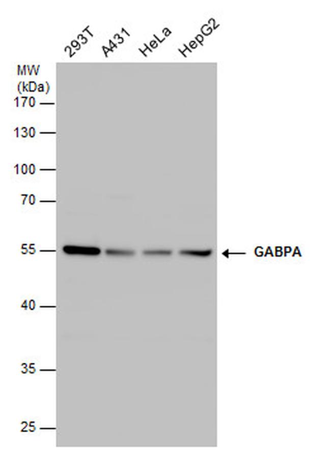 GABPA Antibody in Western Blot (WB)