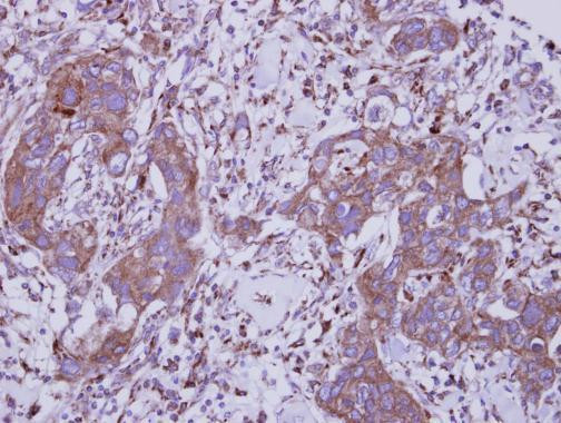 TLR5 Antibody in Immunohistochemistry (Paraffin) (IHC (P))