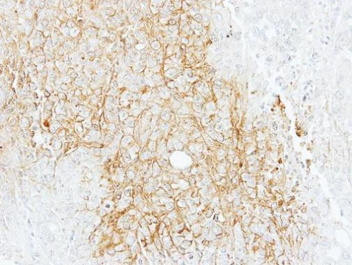 ABCB11 Antibody in Immunohistochemistry (Paraffin) (IHC (P))