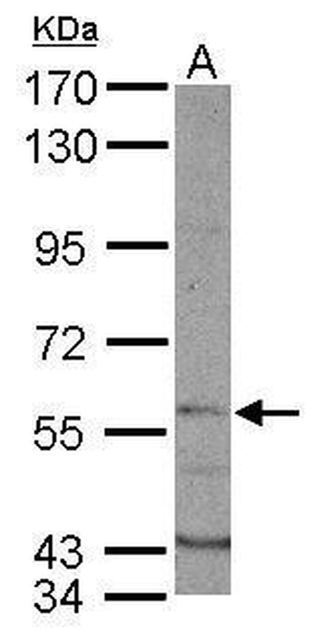 DYRK1B Antibody in Western Blot (WB)