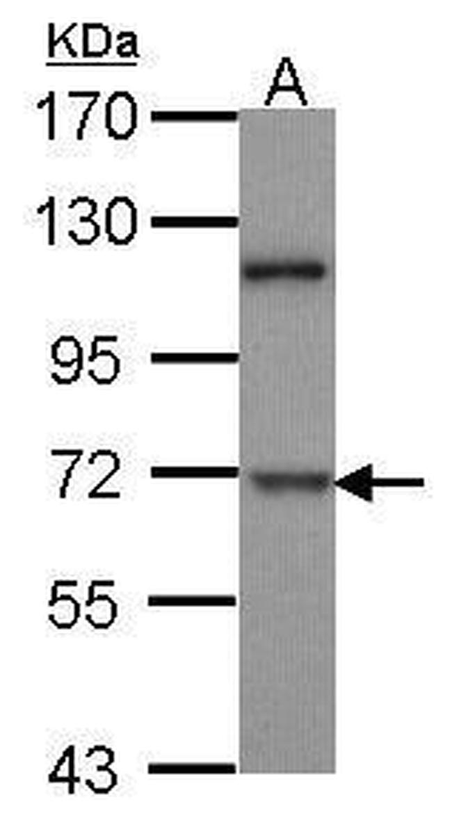 DYRK1B Antibody in Western Blot (WB)