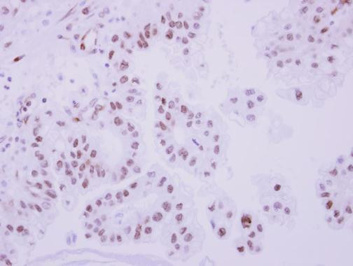 TOP2B Antibody in Immunohistochemistry (Paraffin) (IHC (P))