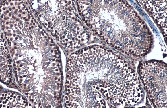 TOP2B Antibody in Immunohistochemistry (Paraffin) (IHC (P))