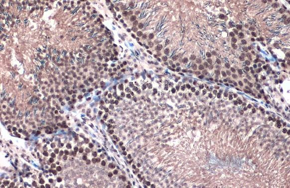 TOP2B Antibody in Immunohistochemistry (Paraffin) (IHC (P))