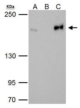 TOP2B Antibody in Immunoprecipitation (IP)