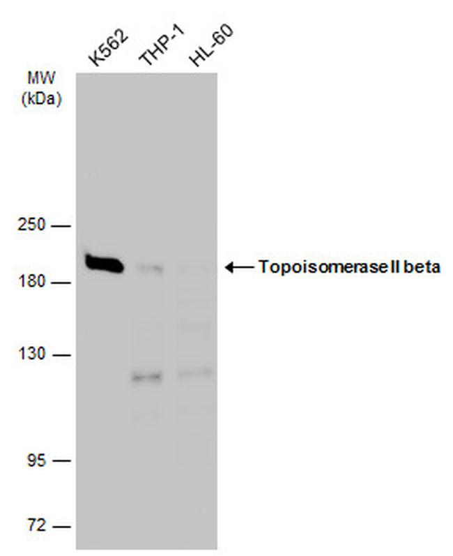 TOP2B Antibody in Western Blot (WB)