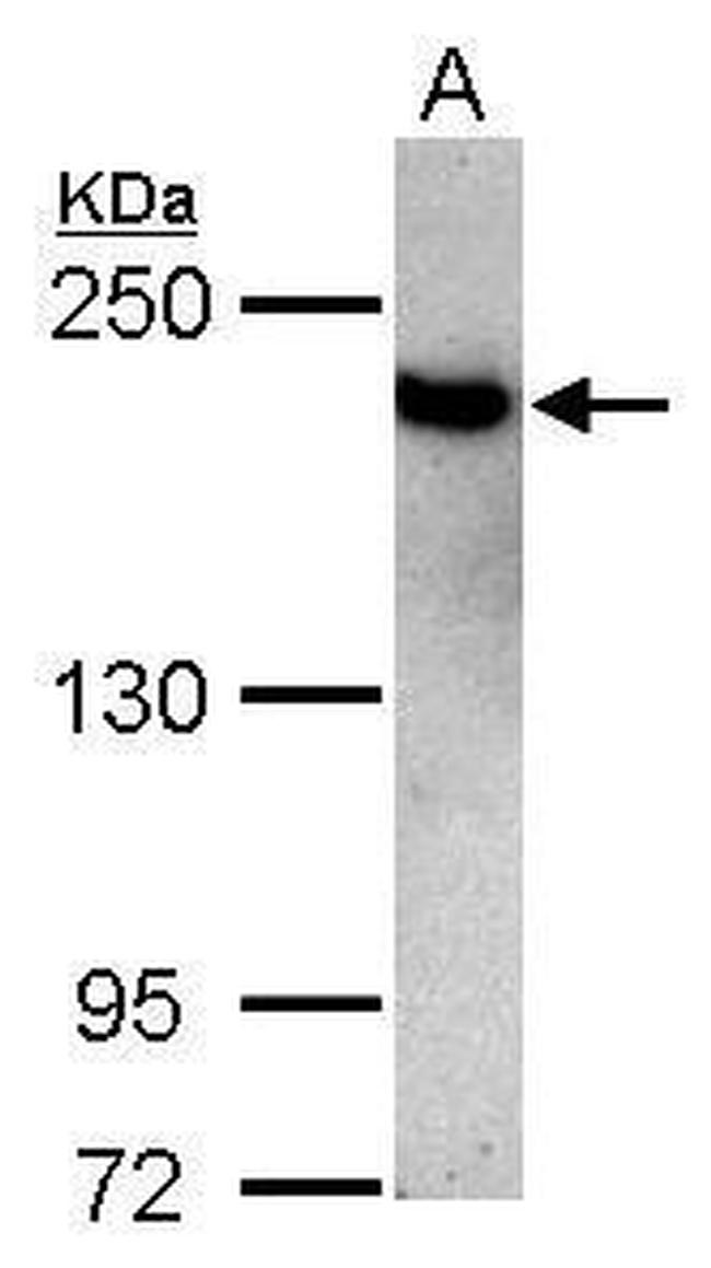 TOP2B Antibody in Western Blot (WB)