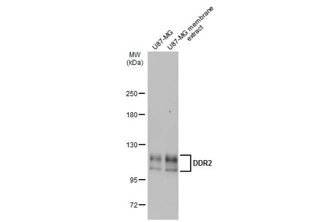 DDR2 Antibody in Western Blot (WB)