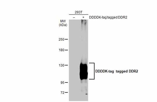 DDR2 Antibody in Western Blot (WB)