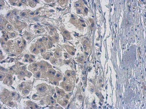 PPME1 Antibody in Immunohistochemistry (Paraffin) (IHC (P))