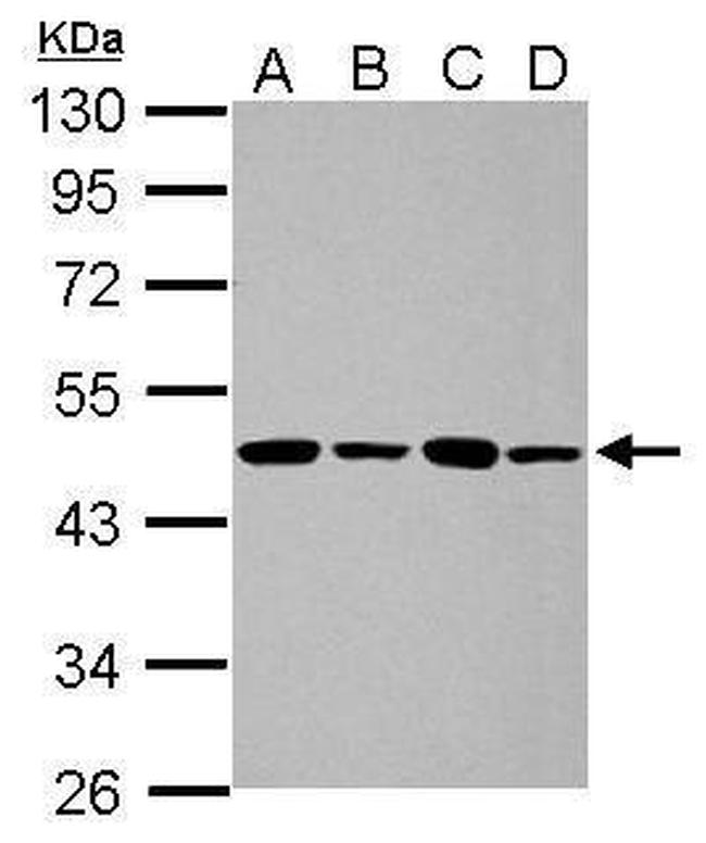 PPME1 Antibody in Western Blot (WB)