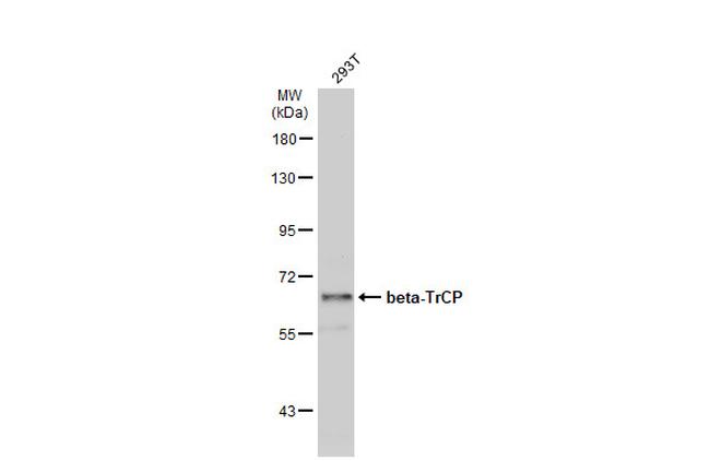 BTRC Antibody in Western Blot (WB)