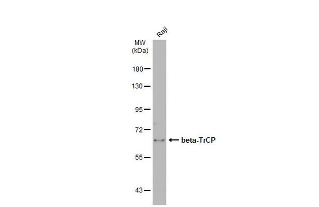 BTRC Antibody in Western Blot (WB)