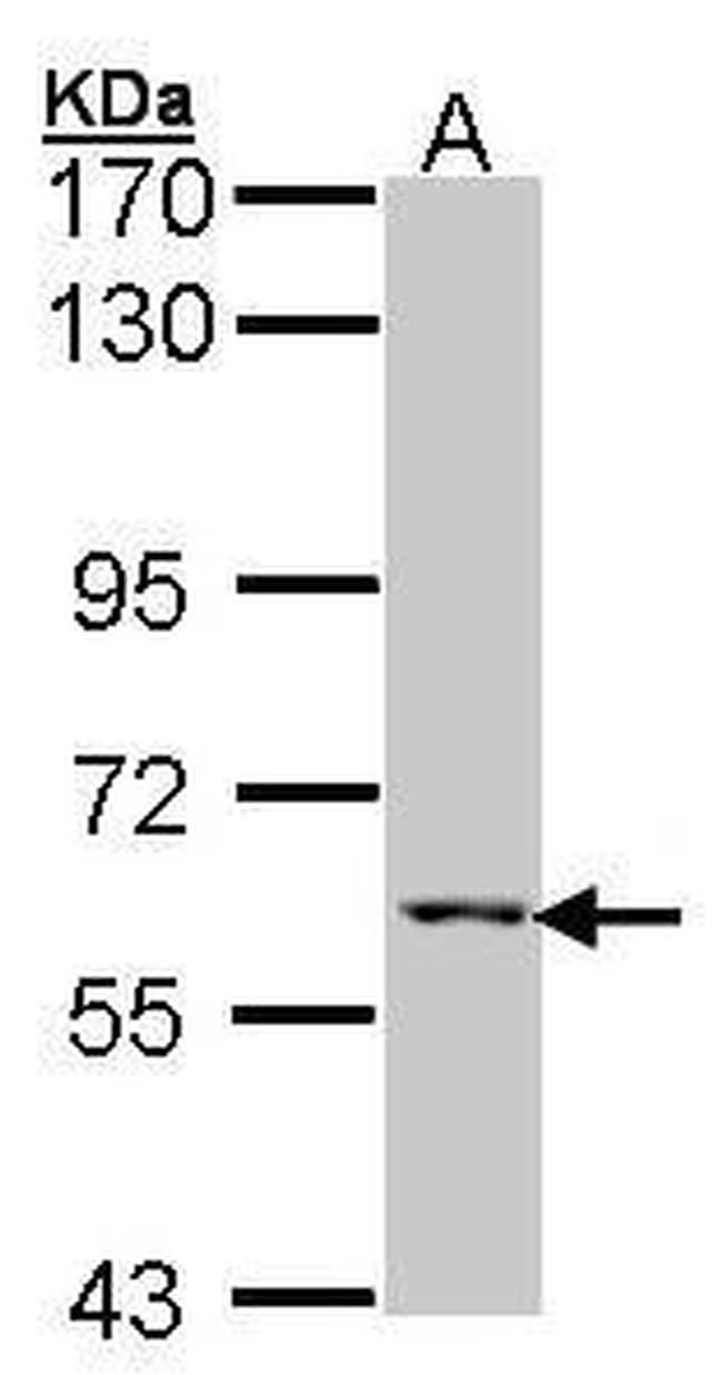 MCCC2 Antibody in Western Blot (WB)