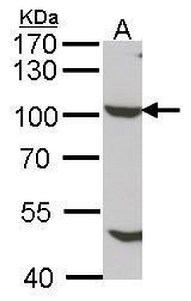 NUP98 Antibody in Western Blot (WB)