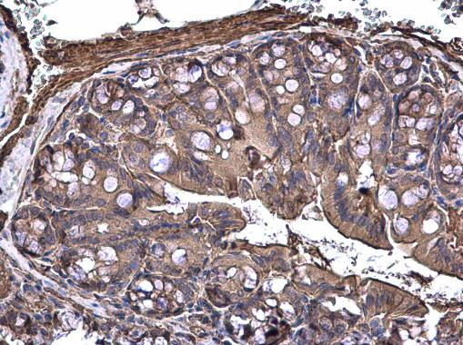 TPL2 Antibody in Immunohistochemistry (Paraffin) (IHC (P))