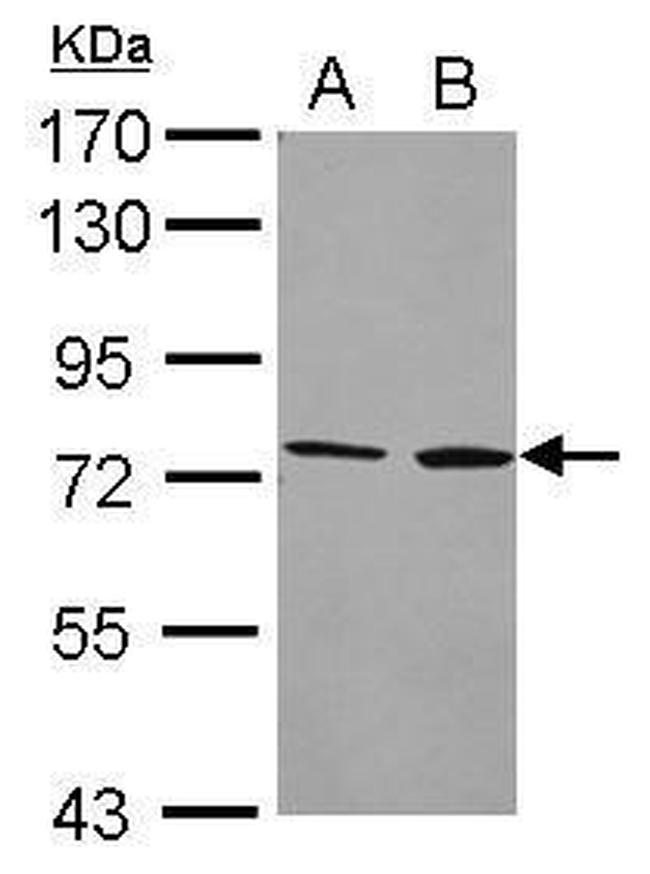 CYP4F2 Antibody in Western Blot (WB)