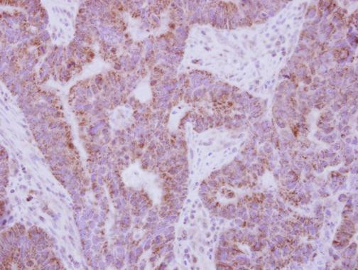 IL10RA Antibody in Immunohistochemistry (Paraffin) (IHC (P))