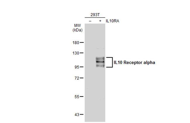 IL10RA Antibody in Western Blot (WB)