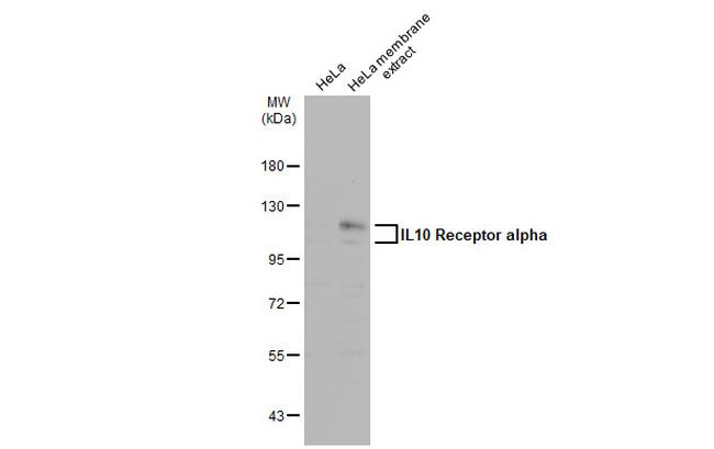 IL10RA Antibody in Western Blot (WB)