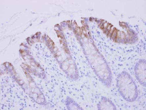 Biglycan Antibody in Immunohistochemistry (Paraffin) (IHC (P))