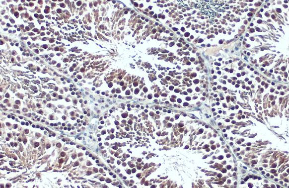 BRPF1 Antibody in Immunohistochemistry (Paraffin) (IHC (P))