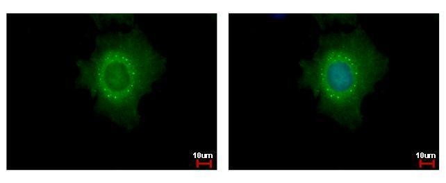 DDX6 Antibody in Immunocytochemistry (ICC/IF)