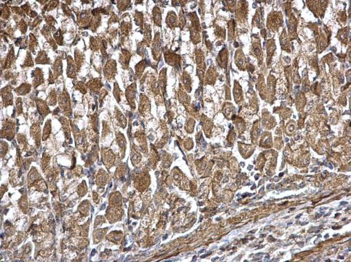 DDX6 Antibody in Immunohistochemistry (Paraffin) (IHC (P))