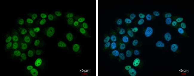 ISL1 Antibody in Immunocytochemistry (ICC/IF)