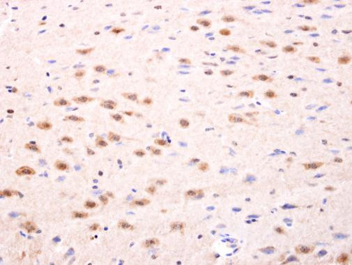 ISL1 Antibody in Immunohistochemistry (Paraffin) (IHC (P))