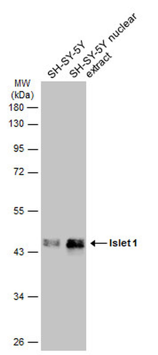 ISL1 Antibody in Western Blot (WB)