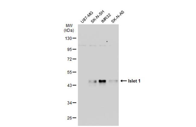 ISL1 Antibody in Western Blot (WB)