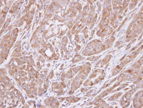 HSD3B2 Antibody in Immunohistochemistry (Paraffin) (IHC (P))