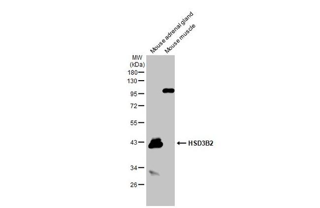 HSD3B2 Antibody in Western Blot (WB)