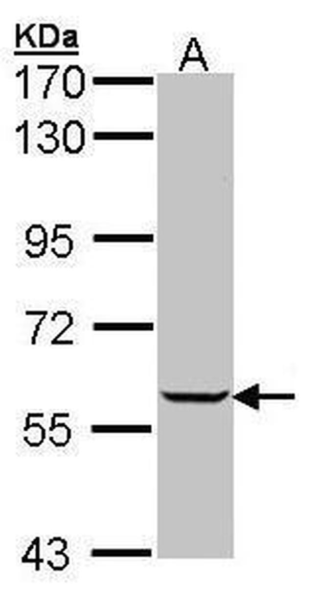 IMPDH1 Antibody in Western Blot (WB)