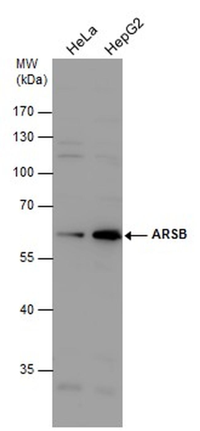 Arylsulfatase B Antibody in Western Blot (WB)