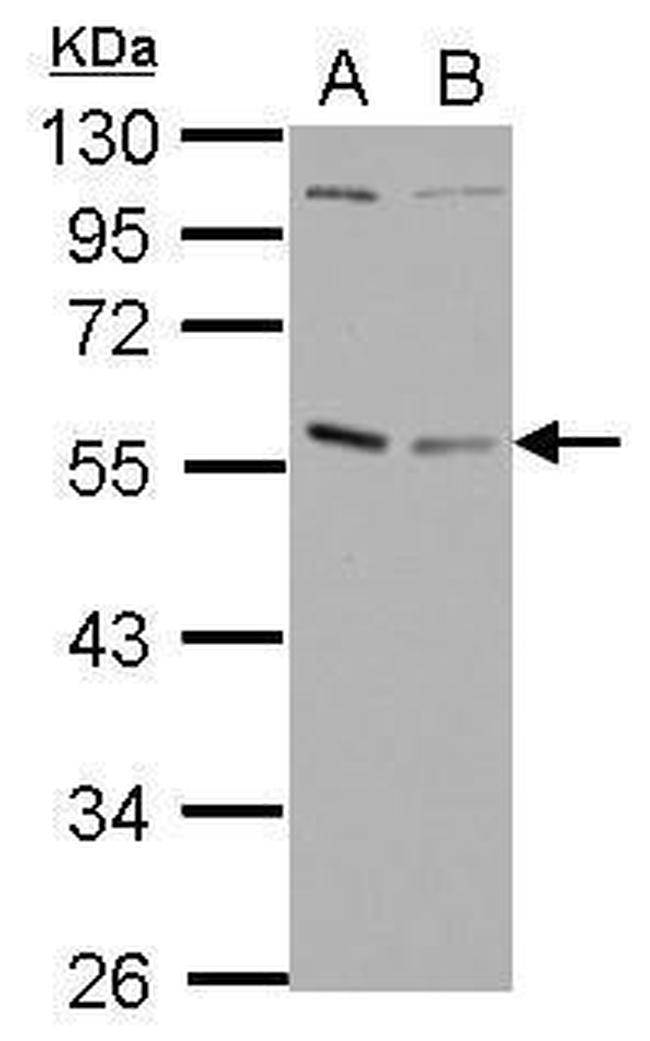 GABPA Antibody in Western Blot (WB)