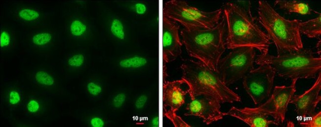 AF9 Antibody in Immunocytochemistry (ICC/IF)