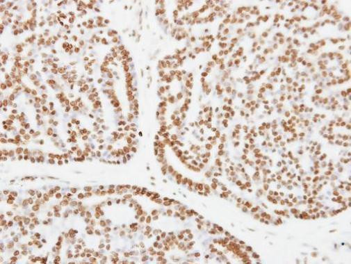 XPC Antibody in Immunohistochemistry (Paraffin) (IHC (P))