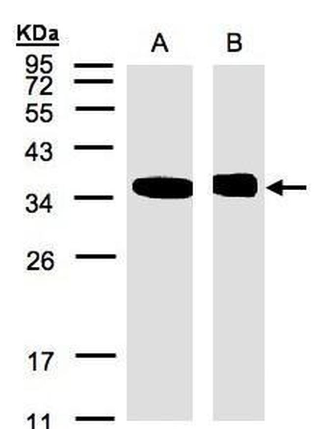 NMI Antibody in Western Blot (WB)