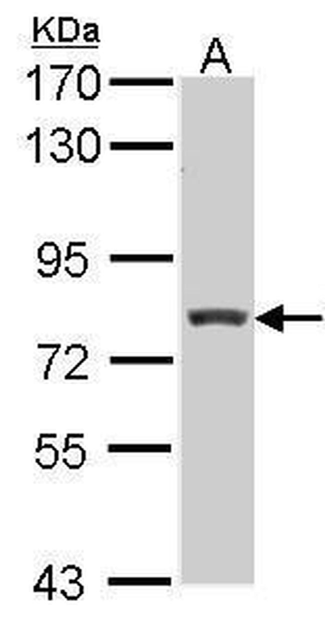 RFX3 Antibody in Western Blot (WB)